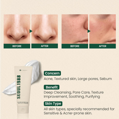 SEOUL 1988 Cleansing Foam : Pine Cica 1% + Probiotics, 150 ml - WowSkin Romania