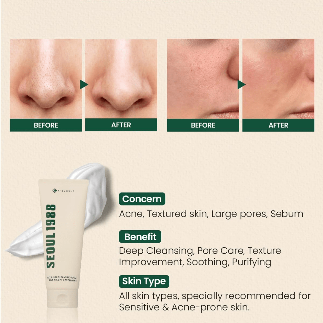 SEOUL 1988 Cleansing Foam : Pine Cica 1% + Probiotics, 150 ml - WowSkin Romania