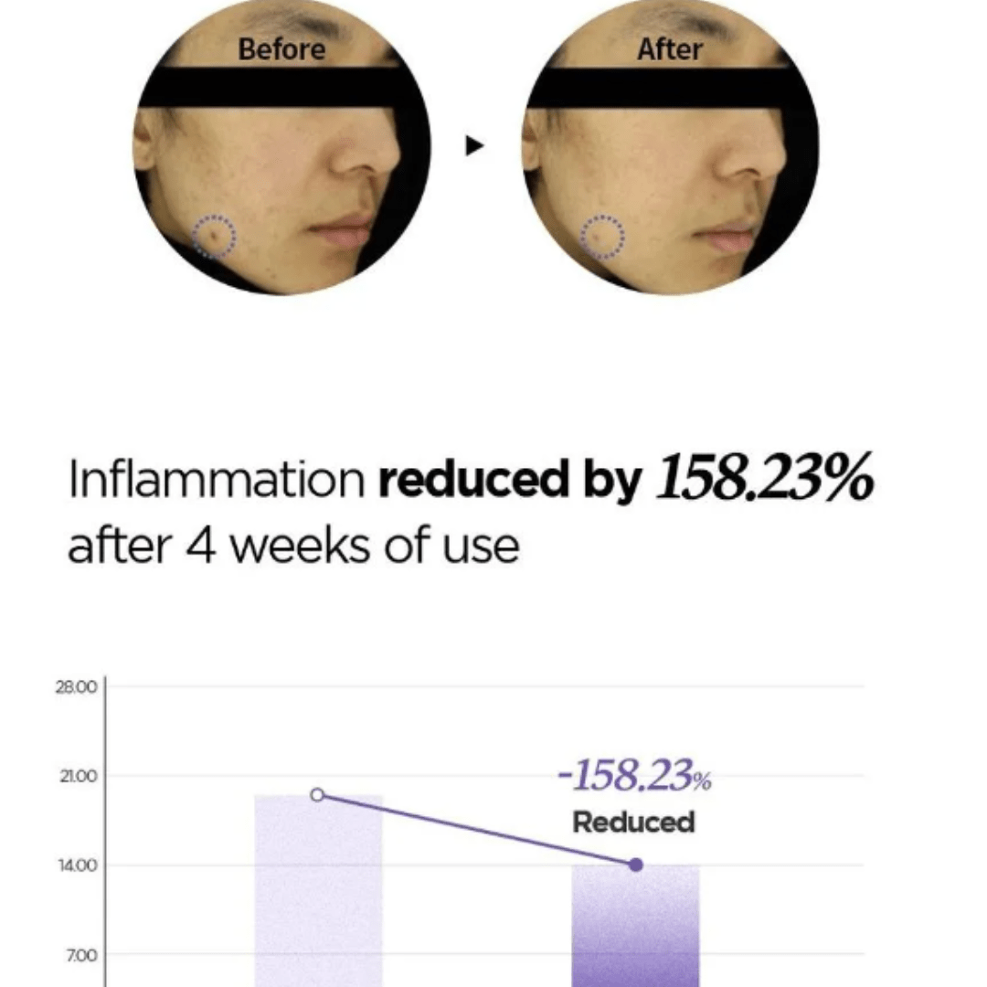 Onion Newpair Spot Patch SKINFIT (Exp: 26.03.2026)