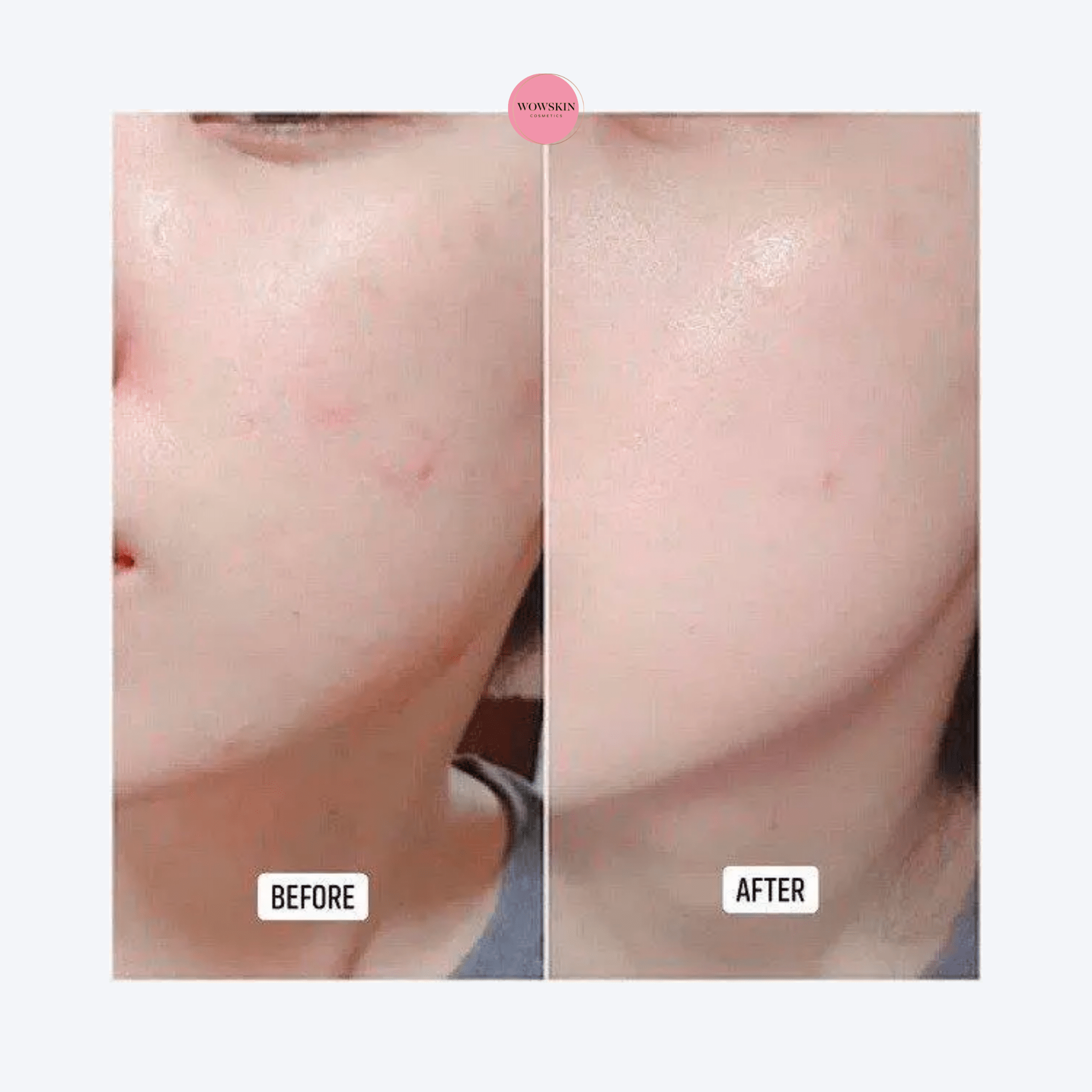 skin-1004-madagascar-centella-hyalu-cica-brightening-toner